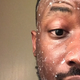 Clumps of glue are essential to good skin.